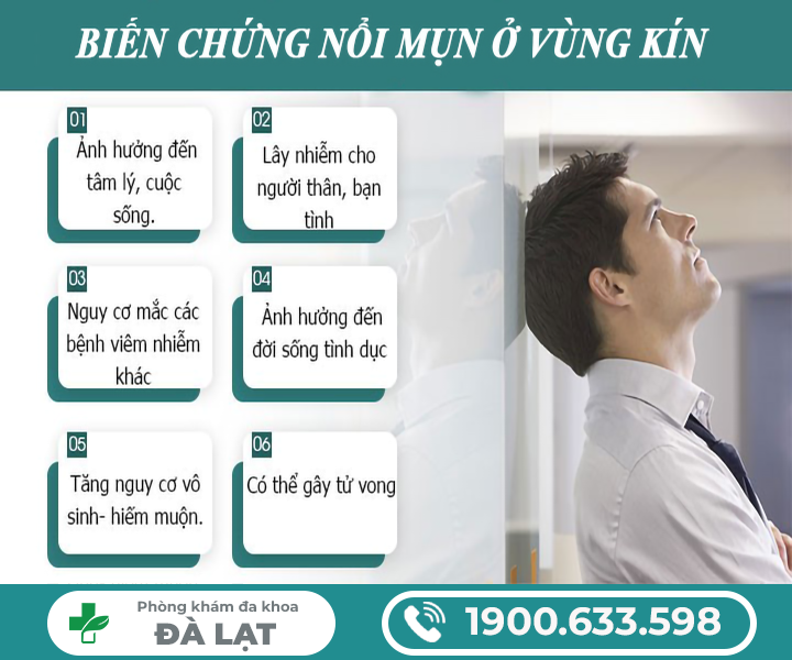 Hình ảnh minh họa